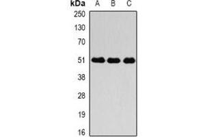Western blot analysis of Fibrinogen gamma expression in SGC996 (A), mouse liver (B), mouse lung (C) whole cell lysates. (FGG anticorps)