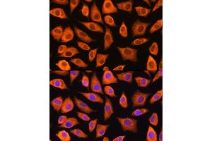 Immunofluorescence analysis of L929 cells using L Rabbit pAb (ABIN1680664, ABIN3018314, ABIN3018315 and ABIN6220434) at dilution of 1:100 (40x lens).