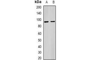 Western blot analysis of IL-1R3 expression in mouse liver (A), mouse heart (B) whole cell lysates. (IL1RAP anticorps)