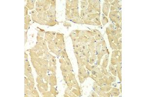 Immunohistochemistry of paraffin-embedded mouse heart using PSMC2 antibody (ABIN5971033) at dilution of 1/100 (40x lens). (PSMC2 anticorps)