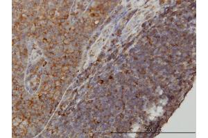Immunoperoxidase of monoclonal antibody to WDR77 on formalin-fixed paraffin-embedded human tonsil. (WDR77 anticorps  (AA 1-342))