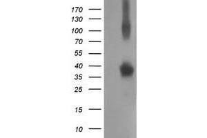 Western Blotting (WB) image for anti-Nonhomologous End-Joining Factor 1 (NHEJ1) antibody (ABIN1499733) (NHEJ1 anticorps)