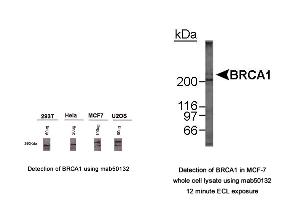 Image no. 3 for anti-Breast Cancer 1 (BRCA1) (AA 1314-1600), (AA 1314-1864) antibody (ABIN363286)