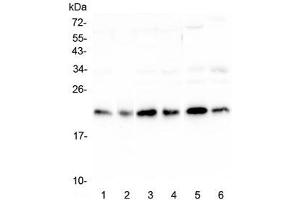 Western blot testing of human 1) HeLa, 2) placenta, 3) HepG2, 4) MCF7, 5) mouse testis and 6) mouse brain lysate with RKIP antibody at 0. (PEBP1 anticorps)