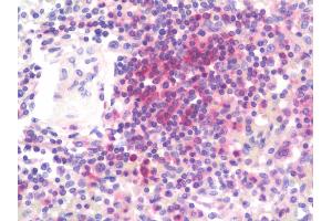 anti-Adenosine Monophosphate Deaminase 3 (AMPD3) (AA 541-776) antibody