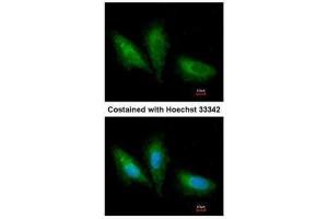 ICC/IF Image Immunofluorescence analysis of paraformaldehyde-fixed A549, using PRKCSH, antibody at 1:200 dilution. (PRKCSH anticorps)