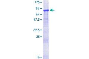 Image no. 1 for ACC Synthase-Like Protein 1 (ACCS) (AA 1-501) protein (GST tag) (ABIN1305631)