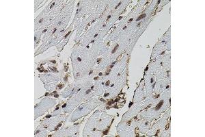 Immunohistochemistry of paraffin-embedded mouse heart using EIF4G2 antibody (ABIN5971499) (40x lens). (EIF4G2 anticorps)
