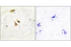 Immunohistochemistry analysis of paraffin-embedded human brain tissue, using UBF1 Antibody. (UBTF anticorps  (AA 501-550))