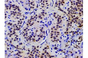 ABIN6267443 at 1/200 staining human duodenum tissue sections by IHC-P.