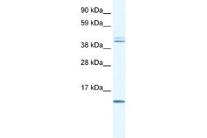 WB Suggested Anti-TSFM Antibody Titration:  0. (TSFM anticorps  (N-Term))