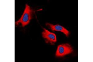Immunofluorescent analysis of RET staining in MCF7 cells. (Ret Proto-Oncogene anticorps  (C-Term))