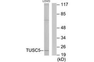 Western blot analysis of extracts from LOVO cells, using TUSC5 Antibody. (TUSC5 anticorps  (AA 1-50))