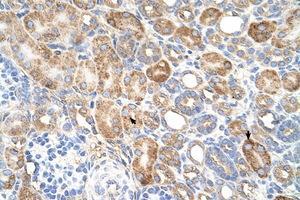 Image no. 1 for anti-Asparagine-Linked Glycosylation 11, alpha-1,2-Mannosyltransferase Homolog (Yeast) (ALG11) (AA 392-441) antibody (ABIN6736673)