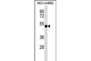 RTDR1 anticorps  (N-Term)