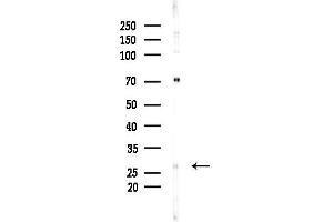 anti-Glutathione S-Transferase omega 2 (GSTO2) (N-Term) antibody