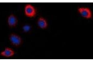 Immunofluorescent analysis of Cytochrome P450 2W1 staining in Hela cells.