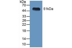 Detection of Recombinant LGMN, Mouse using Polyclonal Antibody to Legumain (LGMN)