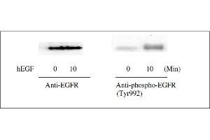 Western blot analysis of extracts from 100 ng/mL hEGF treated A431 cells. (EGFR Kit ELISA)