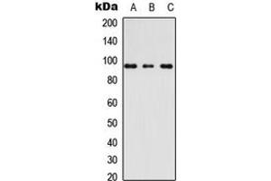 Western blot analysis of AKAP3 expression in Raw264. (AKAP3 anticorps  (Center))