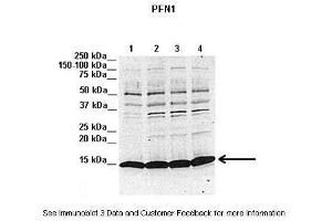 Lanes:   1. (PFN1 anticorps  (N-Term))