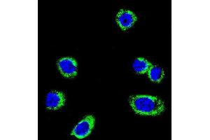 Confocal immunofluorescent analysis of B-RAF Antibody  f with Hela cell followed by Alexa Fluor 488-conjugated goat anti-rabbit lgG (green). (SNRPE anticorps  (AA 424-453))