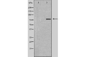 Western blot analysis of extracts from 293 cells using TACC3 antibody. (TACC3 anticorps  (C-Term))