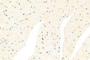 Immunohistochemistry analysis of paraffin-embedded mouse heart using CSL (ABIN7073486) at dilution of 1: 500