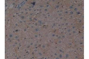 Detection of EPO in Human Liver Tissue using Polyclonal Antibody to Erythropoietin (EPO)