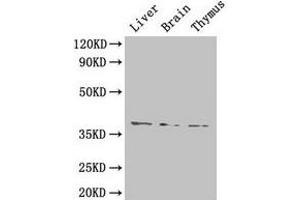 Western Blot Positive WB detected in: Mouse liver tissue, Mouse brain tissue, Mouse thymus tissue All lanes: HAVCR1 antibody at 4 μg/mL Secondary Goat polyclonal to rabbit IgG at 1/50000 dilution Predicted band size: 39 kDa Observed band size: 39 kDa (HAVCR1 anticorps  (AA 21-290))