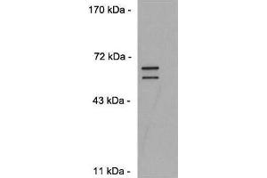 Diluted 1:10,000 on C2C12 cells transfected with pCS2-DUX4. (DUX4 anticorps  (C-Term))