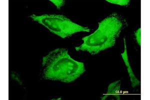 Immunofluorescence of monoclonal antibody to PROCR on HeLa cell.