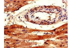 Immunohistochemistry of paraffin-embedded human heart tissue using ABIN7172377 at dilution of 1:100 (TRAPPC9 anticorps  (AA 780-1030))