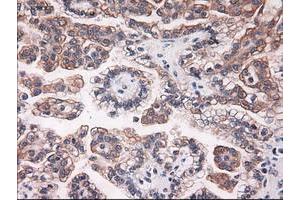 Image no. 6 for anti-Keratin 18 (KRT18) (AA 69-372) antibody (ABIN1491639)