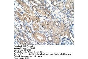 Rabbit Anti-GEM Antibody  Paraffin Embedded Tissue: Human Kidney Cellular Data: Epithelial cells of renal tubule Antibody Concentration: 4. (GEM anticorps  (C-Term))