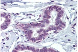 Human Breast (formalin-fixed, paraffin-embedded) stained with MAZ antibody ABIN462205 followed by biotinylated goat anti-rabbit IgG secondary antibody ABIN481713, alkaline phosphatase-streptavidin and chromogen.