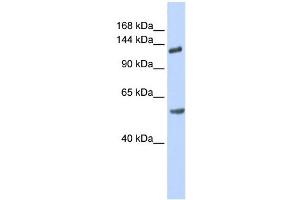 WB Suggested Anti-ROBO2 Antibody Titration: 0. (ROBO2 anticorps  (N-Term))