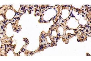 Detection of CK7 in Rat Lung Tissue using Polyclonal Antibody to Cytokeratin 7 (CK7) (Cytokeratin 7 anticorps  (AA 91-394))