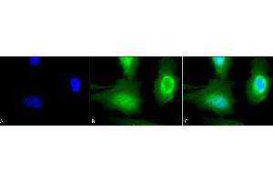 Immunocytochemistry/Immunofluorescence analysis using Rabbit Anti-Calreticulin Polyclonal Antibody (ABIN361834 and ABIN361835).