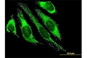 Immunofluorescence of purified MaxPab antibody to PDHB on HeLa cell.