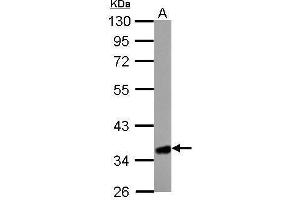 WB Image HMGCL antibody detects HMGCL protein by Western blot analysis.