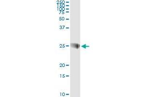 Western Blotting (WB) image for anti-Synaptosomal-Associated Protein, 23kDa (SNAP23) (AA 1-212) antibody (ABIN599065) (SNAP23 anticorps  (AA 1-212))