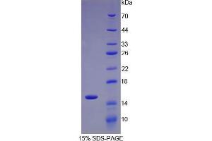 SDS-PAGE analysis of IL34 Protein. (IL-34 Protéine)
