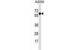 Western Blotting (WB) image for anti-Synaptotagmin IV (SYT4) antibody (ABIN3000889) (SYT4 anticorps)