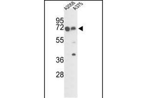 Western blot analysis of FKBP10 Antibody (C-term) (ABIN391573 and ABIN2841510) in  and  cell line lysates (35 μg/lane). (FKBP10 anticorps  (C-Term))