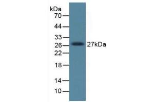 Figure. (DKK1 anticorps  (AA 33-266))