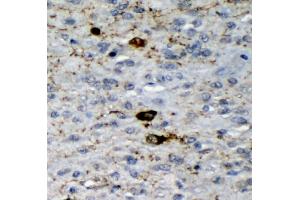 IHC analysis of GAD65/GAD2 using anti-GAD65/GAD2 antibody (ABIN7603170).