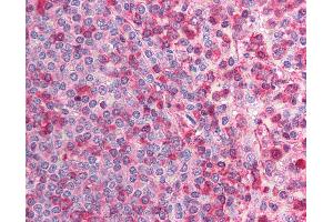 Anti-CACNB2 antibody IHC of human spleen.