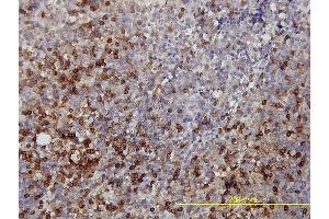 Immunoperoxidase of monoclonal antibody to LDHB on formalin-fixed paraffin-embedded human tonsil tissue.