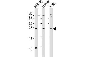 All lanes : Anti-SOST Antibody (N-term) at 1:2000 dilution Lane 1: mouse lung lysates Lane 2: human liver lysates Lane 3: Hela whole cell lysates Lysates/proteins at 20 μg per lane. (Sclerostin anticorps  (N-Term))